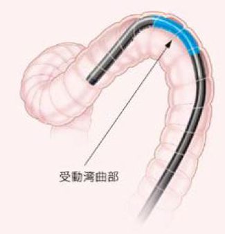 受動